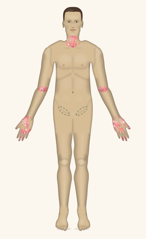 Cascade Dermatology model