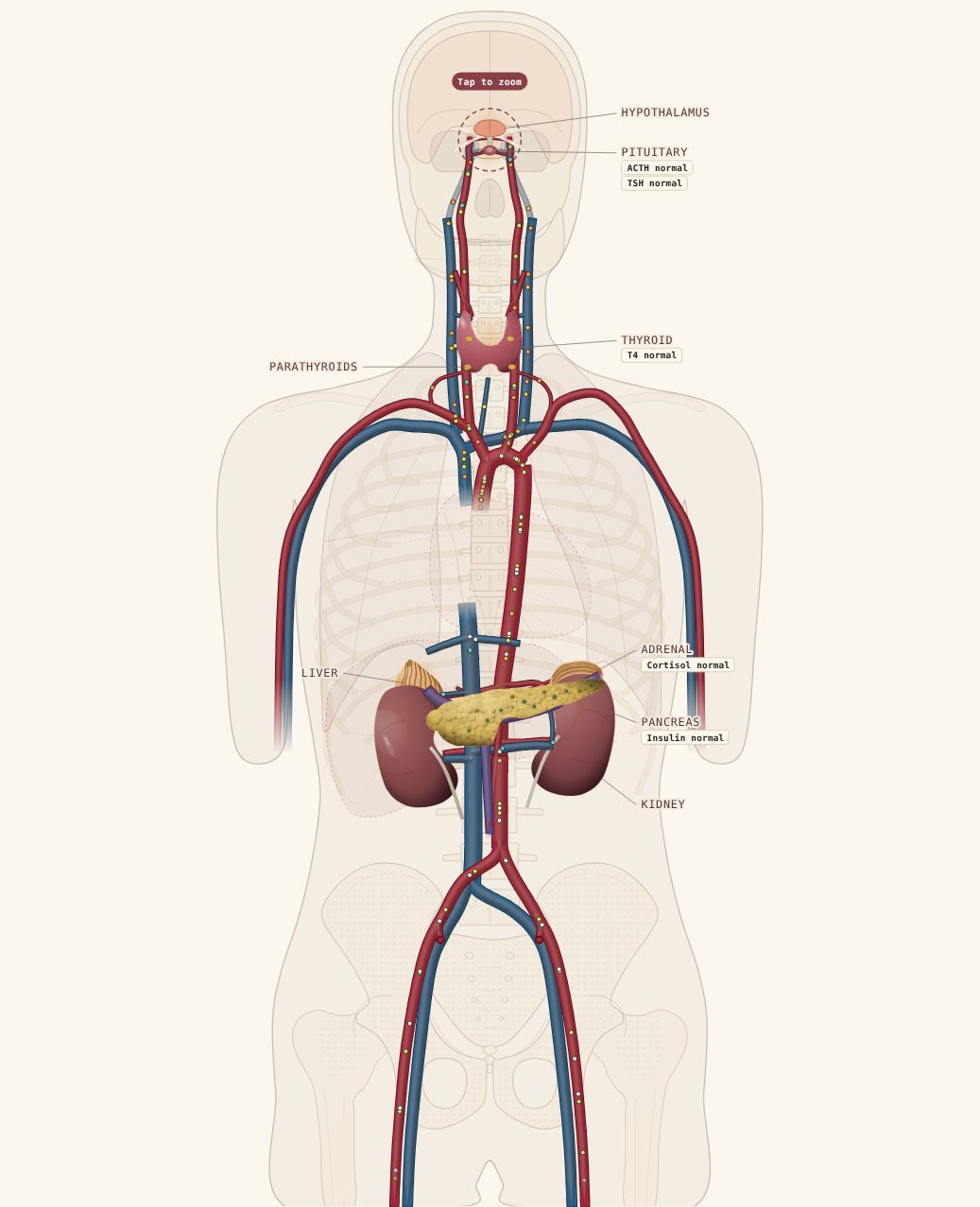 Cascade Endocrine model