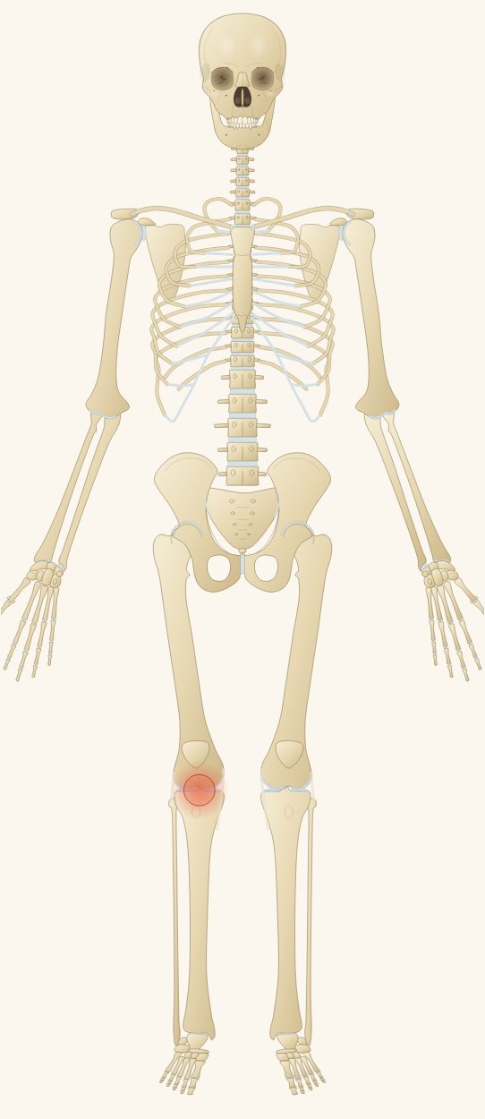 Cascade MSK and rheumatology model