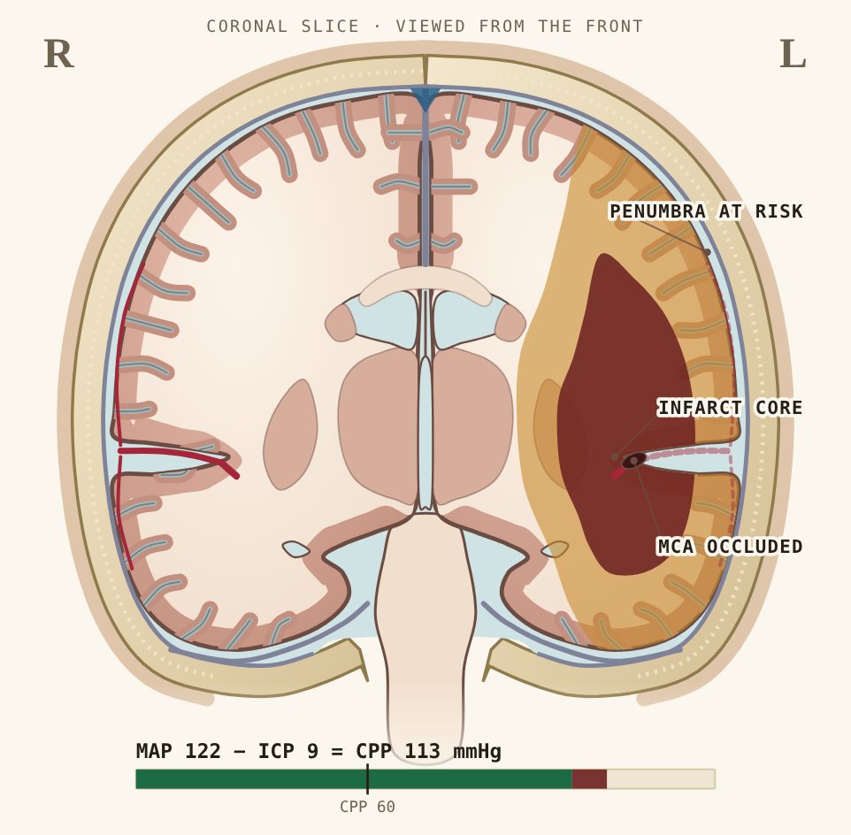 Cascade Neurology model